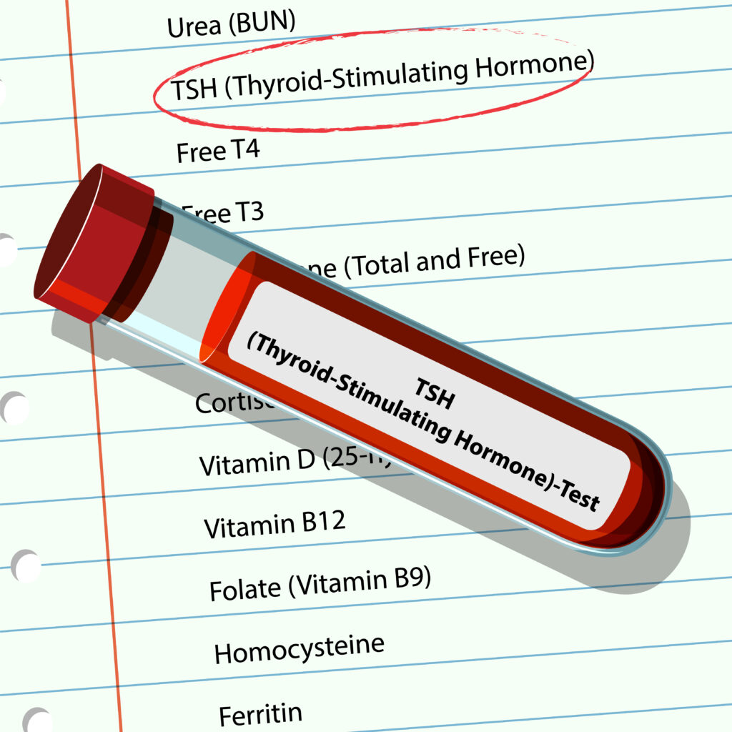 thyroid hormone test illustration